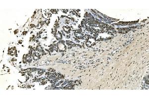 IHC analysis of LSM7 using anti-LSM7 antibody (ABIN7598937). (LSM7 抗体  (AA 1-103))