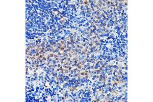 Immunohistochemistry of paraffin-embedded rat spleen using GRB2 Rabbit mAb (ABIN7267518) at dilution of 1:100 (40x lens).