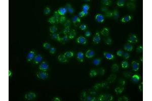 Image no. 1 for anti-Mitogen-Activated Protein Kinase 11 (MAPK11) antibody (ABIN1500806)