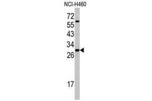 Western blot analysis of SFRS5 antibody (Center Y85) in NCI-H460 cell line lysates (35ug/lane). (SRSF5 抗体  (Middle Region))
