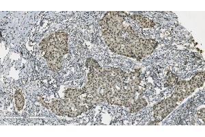 IHC analysis of PARP using anti-PARP antibody (ABIN7602278). (PARP1 抗体  (AA 670-858))