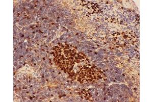 IHC-P: Beclin 1 antibody testing of mouse spleen tissue (Beclin 1 抗体  (AA 1-354))