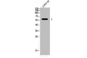 Western Blot analysis of LOVO+UV cells using Phospho-Fyn (Y530) Polyclonal Antibody (FYN 抗体  (pTyr530))