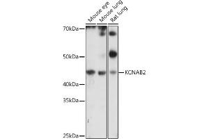 Western blot analysis of extracts of various cell lines, using KCN antibody (ABIN7269481) at 1:1000 dilution. (KCNAB2 抗体  (AA 1-40))