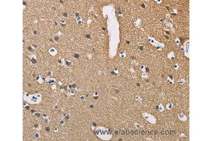 Immunohistochemistry of Human brain  using PPP3CA Polyclonal Antibody at dilution of 1:40 (PPP3CA 抗体)