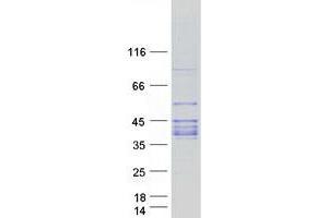 Western Blotting (WB) image for Histo-blood group A transferase (ABO) protein (Myc-DYKDDDDK Tag) (ABIN2714288)