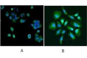 IF/ICC testing of human A) MCF7 and B) HeLa cells with DJ-1 antibody at 5ug/ml + DAPI nuclear counterstain. (PARK7/DJ1 抗体)