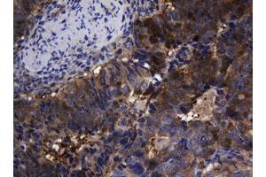 Image no. 4 for anti-TSC22 Domain Family, Member 1 (TSC22D1) antibody (ABIN1501537)