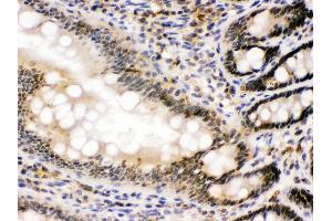 nmt55/p54nrb was detected in paraffin-embedded sections of rat intestine tissues using rabbit anti- nmt55/p54nrb Antigen Affinity purified polyclonal antibody at 1 μg/mL. (NONO 抗体  (N-Term))