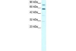 WB Suggested Anti-SND1 Antibody Titration:  1. (SND1 抗体  (N-Term))