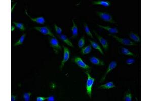 Immunofluorescent analysis of Hela cells using ABIN7170199 at dilution of 1:100 and Alexa Fluor 488-congugated AffiniPure Goat Anti-Rabbit IgG(H+L) (SLC25A46 抗体  (AA 1-102))