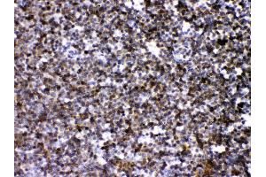 Immunohistochemistry (IHC) image for anti-rho Guanine Nucleotide Exchange Factor (GEF) 1 (ARHGEF1) (AA 41-71), (N-Term) antibody (ABIN4886475)