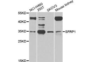Western blot analysis of extracts of various cell lines, using SFRP1 antibody (ABIN5975810) at 1/1000 dilution. (SFRP1 抗体)