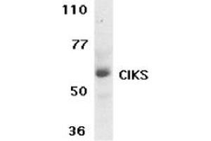 Image no. 1 for anti-TRAF3 Interacting Protein 2 (TRAF3IP2) (AA 554-568) antibody (ABIN205307) (TRAF3IP2 抗体  (AA 554-568))