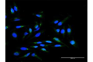 Immunofluorescence of purified MaxPab antibody to SCYL1BP1 on HeLa cell. (GORAB 抗体  (AA 1-246))