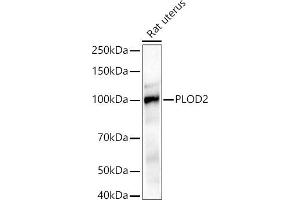 Western blot analysis of extracts of Rat uterus, using PLOD2/LH2 antibody (ABIN6132888, ABIN6145788, ABIN6145790 and ABIN6222693) at 1:1000 dilution. (PLOD2 抗体  (AA 470-650))