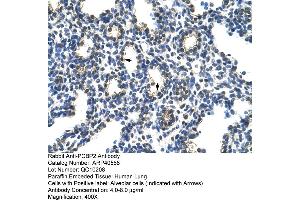 Rabbit Anti-PCBP2 Antibody  Paraffin Embedded Tissue: Human Lung Cellular Data: Alveolar cells Antibody Concentration: 4. (PCBP2 抗体  (Middle Region))