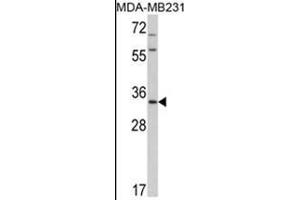 Western blot analysis of HPGD Antibody (C-term) in MDA-MB231 cell line lysates (35ug/lane). (HPGD 抗体  (C-Term))