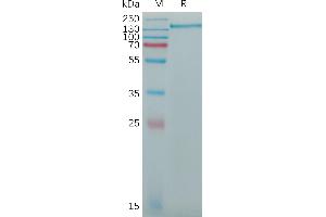 SDS-PAGE (SDS) image for CD163 (CD163) (AA 44-1048) protein (His tag) (ABIN7491327)