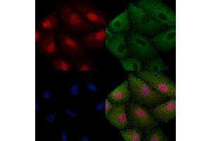 ABIN6257593 and ABIN6274990 staining  cells by IF/ICC. (CEP57 抗体  (Internal Region))