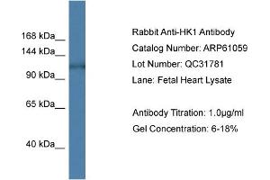 Western Blotting (WB) image for anti-Hexokinase 1 (HK1) (N-Term) antibody (ABIN2788663) (Hexokinase 1 抗体  (N-Term))