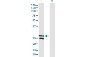 Western Blot analysis of C12orf72 expression in transfected 293T cell line by C12orf72 MaxPab polyclonal antibody. (METTL20 抗体  (AA 1-262))
