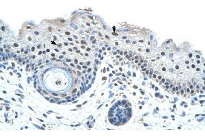 SF3B1 antibody was used for immunohistochemistry at a concentration of 4-8 ug/ml to stain Epidermal cells (arrows) in Human Skin. (SF3B1 抗体  (N-Term))