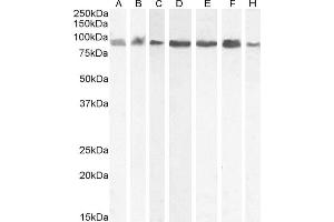Western Blotting (WB) image for anti-Karyopherin (Importin) beta 1 (KPNB1) (C-Term) antibody (ABIN185516)