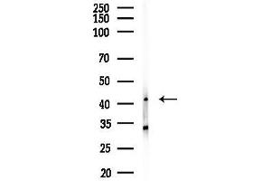 anti-Clavesin 1 (CLVS1) antibody