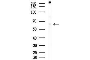 Western blot analysis of lysates from EC304 cells, using Phospho-Estrogen Receptor alpha (Ser118) Antibody at 1/1000 dilution.