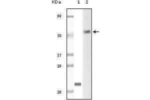 Western Blotting (WB) image for anti-Lymphocyte-Specific Protein tyrosine Kinase (LCK) (truncated) antibody (ABIN2464076) (LCK 抗体  (truncated))