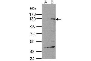 WB Image Western Blot analysis of SIPA1 expression in transfected 293T cell line by SIPA1 polyclonal antibody.