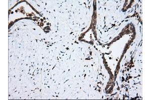 Immunohistochemical staining of paraffin-embedded Human prostate tissue using anti-TBXAS1 mouse monoclonal antibody. (TBXAS1 抗体)