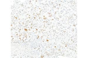 Immunohistochemistry (IHC) image for anti-gamma Histone Variant H2AX (GAMMA-H2AX) (Ser140) antibody (ABIN7455200) (Recombinant gamma H2AX 抗体  (Ser140))