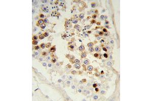 Formalin-fixed and paraffin-embedded human testis tissue reacted with SNAI Antibody, which was peroxidase-conjugated to the secondary antibody, followed by DAB staining. (SNAI 抗体)