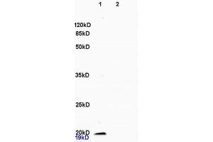 L1 rat brain, L2 rat heart lysates probed (ABIN736521) at 1:200 in 4 °C.