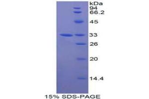 SDS-PAGE analysis of Human GAB3 Protein. (GAB3 蛋白)