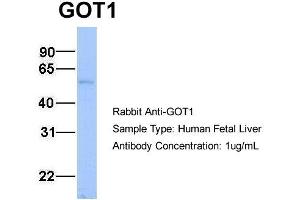 Host:  Rabbit  Target Name:  GOT1  Sample Type:  Human Fetal Liver  Antibody Dilution:  1. (GOT1 抗体  (N-Term))