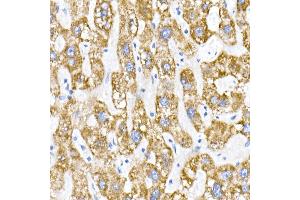 Immunohistochemistry of paraffin-embedded human liver using ACADS / SCAD Rabbit mAb (ABIN7265419) at dilution of 1:50 (40x lens). (ACADS 抗体)