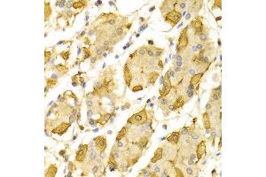 Immunohistochemistry of paraffin-embedded Human gastric using HSD17B2 antibody at dilution of 1:100 (x400 lens). (HSD17B2 抗体  (AA 118-387))
