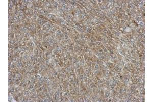 IHC-P Image Immunohistochemical analysis of paraffin-embedded Hela xenograft, using NCF1, antibody at 1:500 dilution. (NCF1 抗体)