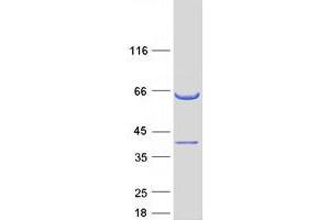 Validation with Western Blot
