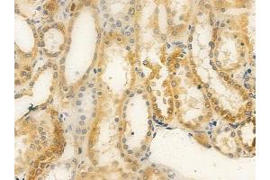 ABIN6259615 and ABIN6275472 at 1/100 staining human normal kidney tissue by IHC-P. (WTH3DI 抗体  (Internal Region))