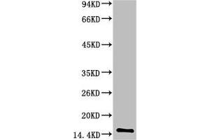 Western blot analysis of Human Serum using TTR Mouse mAb diluted at 1:2000 (TTR 抗体)