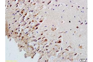 Formalin-fixed and paraffin embedded rat brain labeled with Rabbit Anti-MAP2/MAP-2a.