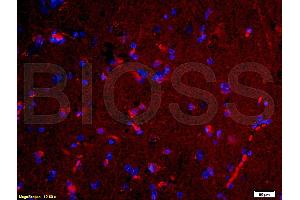 Formalin-fixed and paraffin-embedded human brain labeled with Rabbit Anti-NGAL Polyclonal Antibody, Unconjugated (ABIN685627) 1:200 followed by conjugation to the PE secondary antibody and DAPI staining (Lipocalin 2 抗体  (AA 101-198))