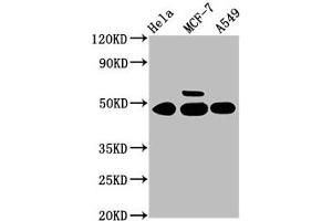 Western Blot Positive WB detected in: Hela whole cell lysate, MCF-7 whole cell lysate, A549 whole cell lysate All lanes: CSNK1G1 antibody at 3. (CSNK1G1 抗体  (Isoform gamma 1))