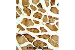 Formalin-fixed and paraffin-embedded human skeletal muscle with CDKN1B (phospho S10) polyclonal antibody , which was peroxidase-conjugated to the secondary antibody, followed by DAB staining. (CDKN1B 抗体  (pSer10))