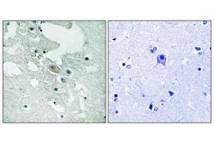 Immunohistochemistry analysis of paraffin-embedded human brain tissue using BLNK (Phospho-Tyr84) antibody. (B-Cell Linker 抗体  (pTyr84))