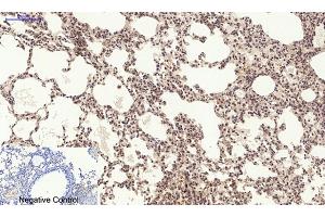 Immunohistochemical analysis of paraffin-embedded mouse lung tissue. (PERK 抗体  (pThr981))